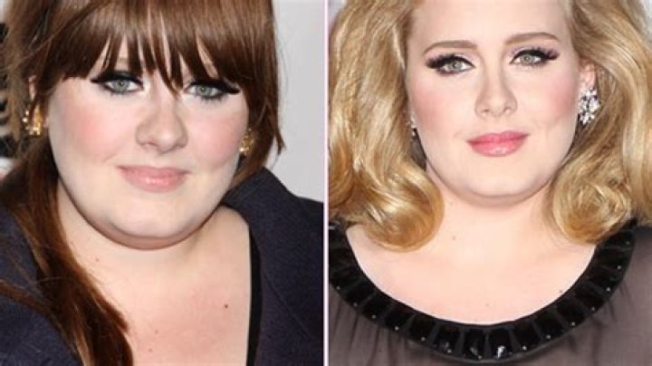 Adele Nose Job — Plastic Surgeons Confirm Adele Plastic Surgery Rumors – Hollywood Life