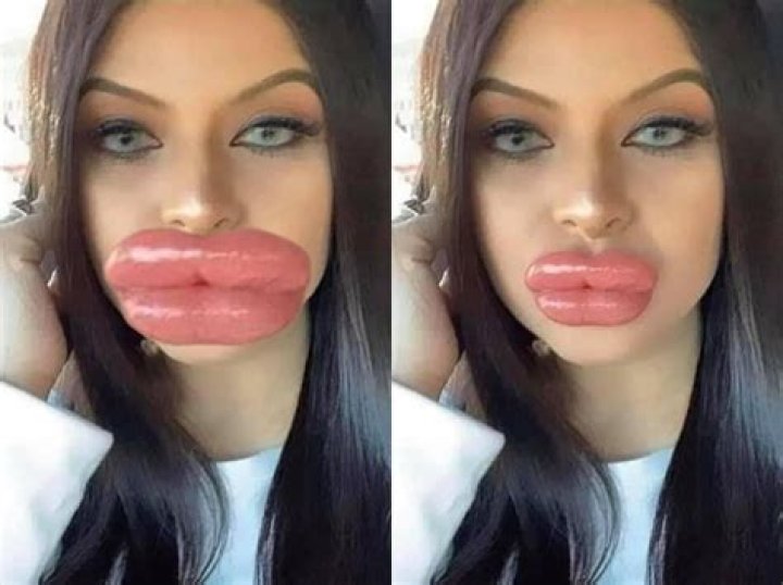 Stars Who Fueled Injection Rumors – Hollywood Life