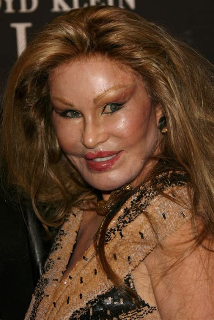 9 Times Celebs Have Confessed To Weird Surgeries: Kris Jenner Reducing Her Ear & More — PICS