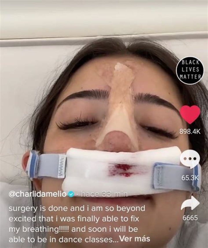 She Rocks Bandages While Dancing – Hollywood Life