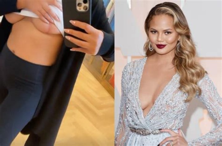 Chrissy Teigen Reveals She Wants Another Procedure To Make Breasts Smaller After Implant Removal