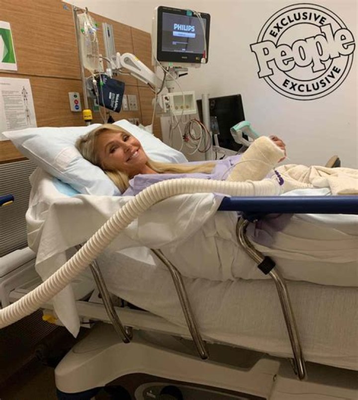Christie Brinkley Reveals She Broke Her Arm ‘Into 1,000 Pieces’ Before Pulling Out Of ‘DWTS’