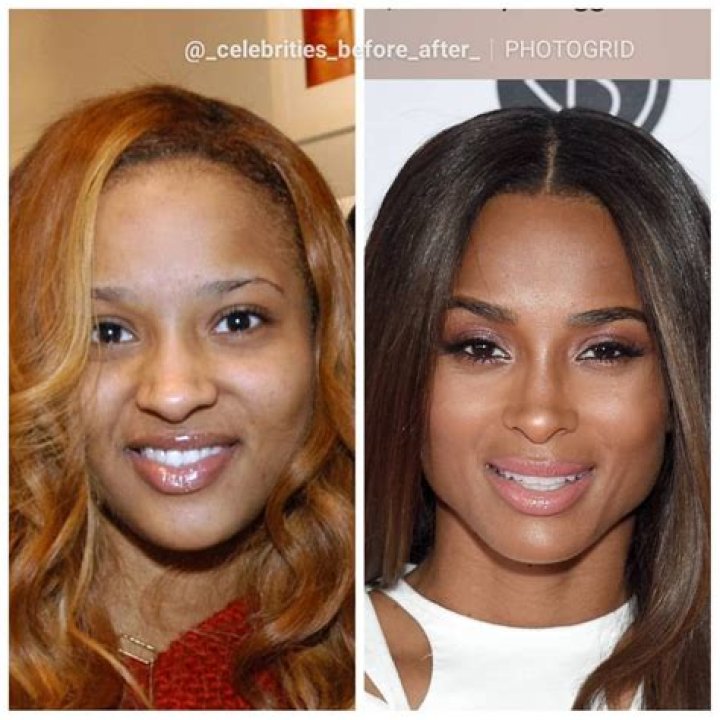 Ciara Supports Husband Russell Wilson After Surgery: Photo – Hollywood Life