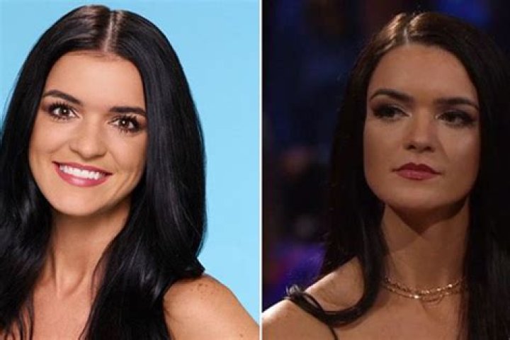 Did ‘Bachelor’ Star Raven Get A Nose Job? Experts Weigh In On Plastic Surgery Rumor