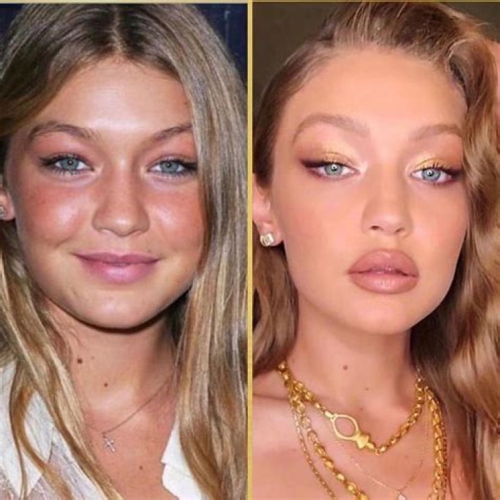 Gigi Hadid Responds To Cheek Filler Speculation Amid Pregnancy: Watch – Hollywood Life