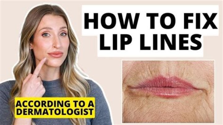 The New Way To Erase Annoying Lines Around Your Lips — Dermatologist Shares Advice
