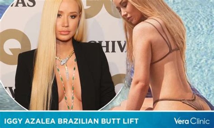 Did She Get Plastic Surgery? Expert Speaks – Hollywood Life