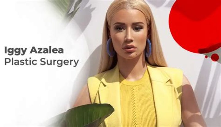 Did Iggy Azalea Have More Plastic Surgery & Fillers? Experts Think So – Hollywood Life