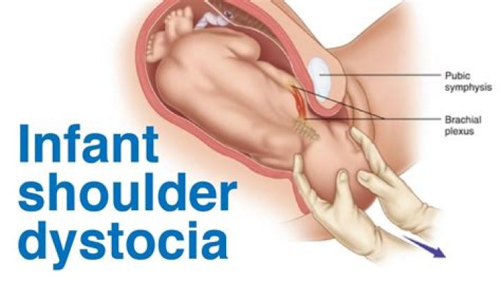 ‘RHOC’s Kara Keough: Why Her Baby Dying From Shoulder Dystocia Is ‘Rare’ – Doctor Explains