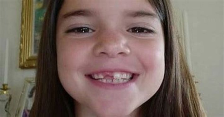 Kendall Jenner Shows Off Missing Teeth In Throwback Photo – Hollywood Life