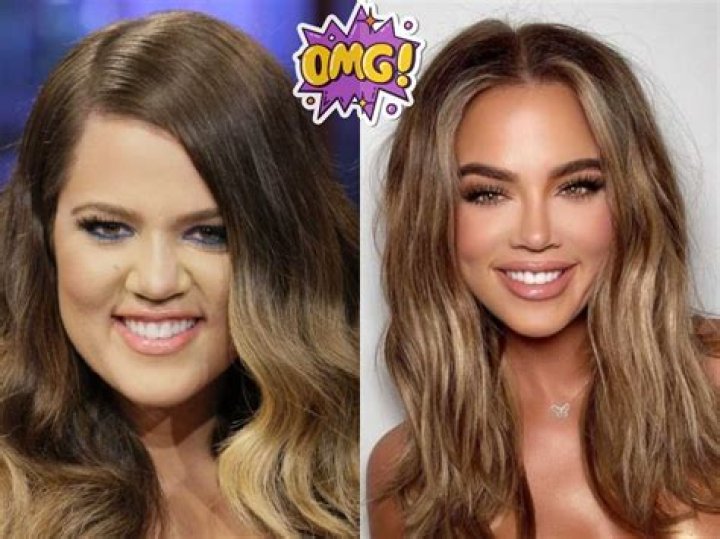 Khloe Kardashia’s Braces At 28 — Her Doc Talks On The Celeb Treatment – Hollywood Life