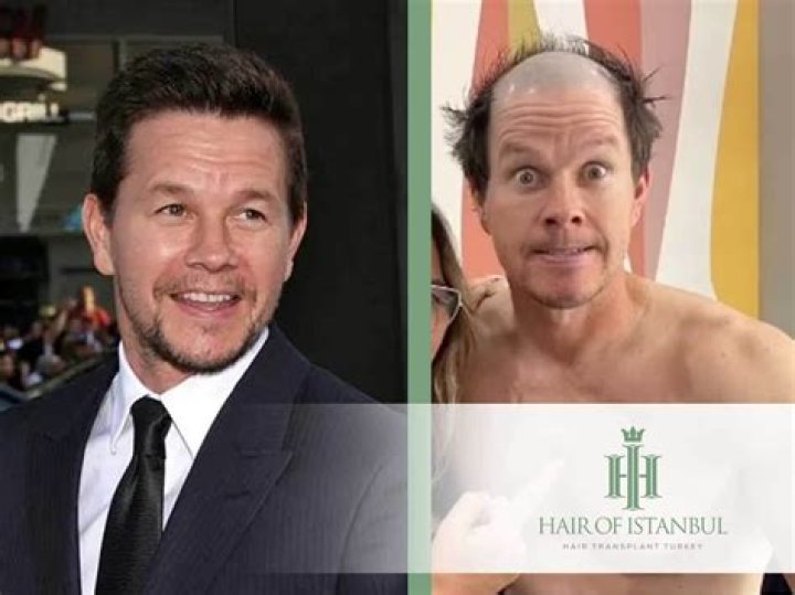 Mark Wahlberg Shows Off Shaved Head — See Before & After Pics – Hollywood Life