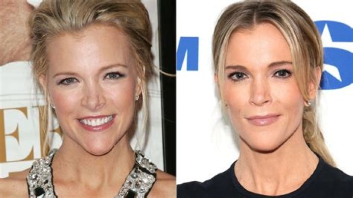 [PICS] Megyn Kelly Nose Job — Did She Get Plastic Surgery? See Photos – Hollywood Life