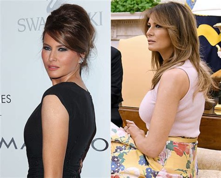 Did Melania Trump Get A Boob Job? See Before And After Pics – Hollywood Life