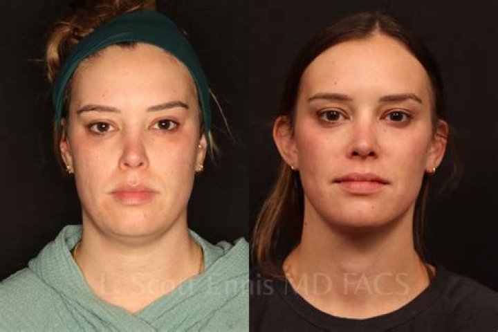 ‘RHONJ’ Star Jennifer Aydin Loses 25 Lbs. After Getting Breast Reduction & Liposuction