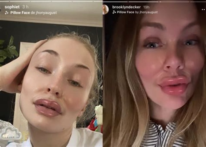 Sophie Turner Plumps Up Her Lips To Twice Their Size In Wild, Filtered Selfie — See Pic