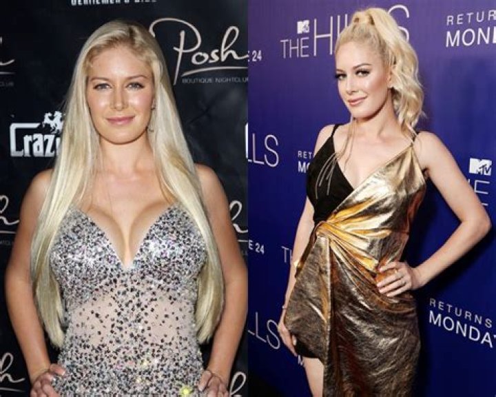 Celebs Removing Implants – Hollywood Life