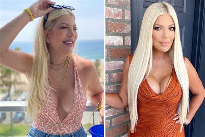 Tori Spelling Shares Breast Implant Removal Journey: Video – Hollywood Life