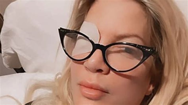 Tori Spelling Reveals How She Got Eye Ulcer That Resulted In Wearing Bedazzled Eye Patch: ‘It’s My Fault’