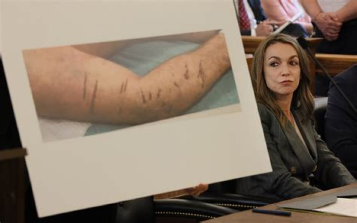 Vester Flanagan: TV Shooter’s Autopsy Photo Being Shopped To Media